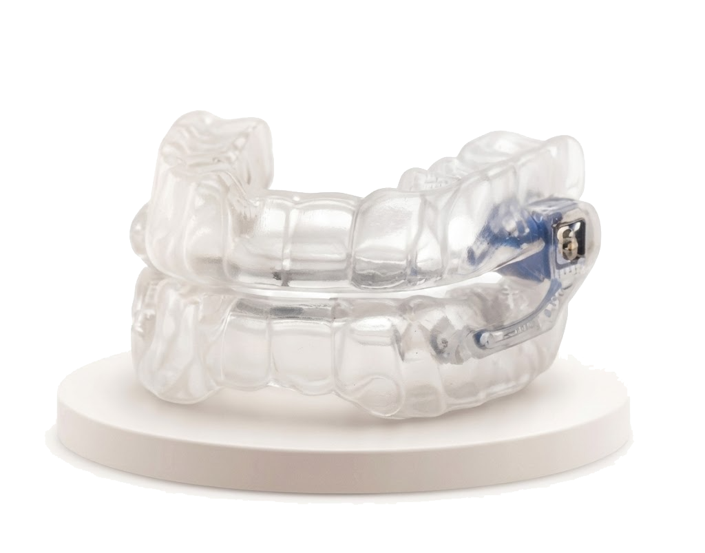 Custom Oral Appliance for Sleep Apnea