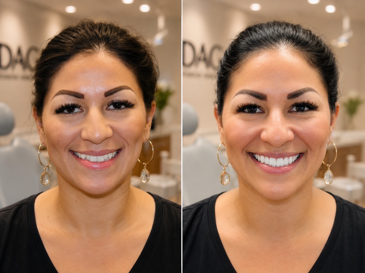 Cosmetic Dentist Houston - Smile Consultation